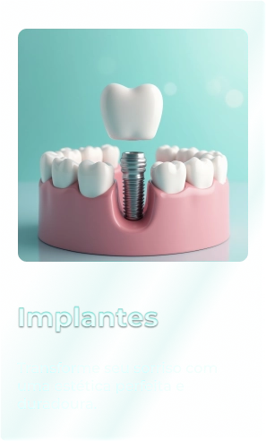 Card_Vidro_Implantes